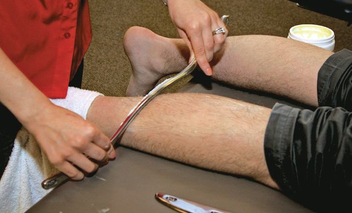 Instrument Assisted Soft Tissue Mobilization of the Calf