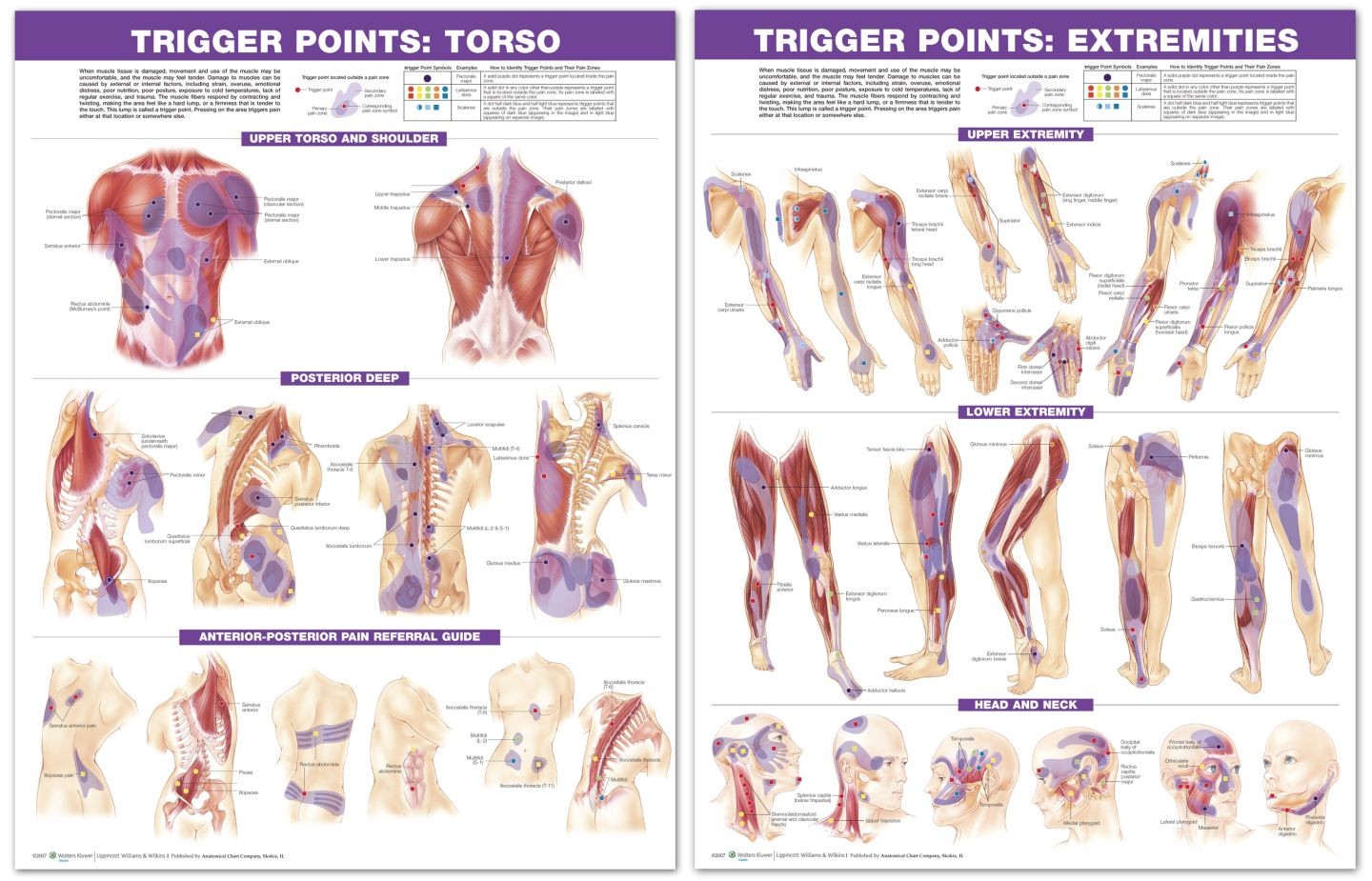 Myofascial Syndrome Trigger Points Chart